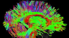 Colorful image of a brain captured by MRI diffusion tensor imaging scan