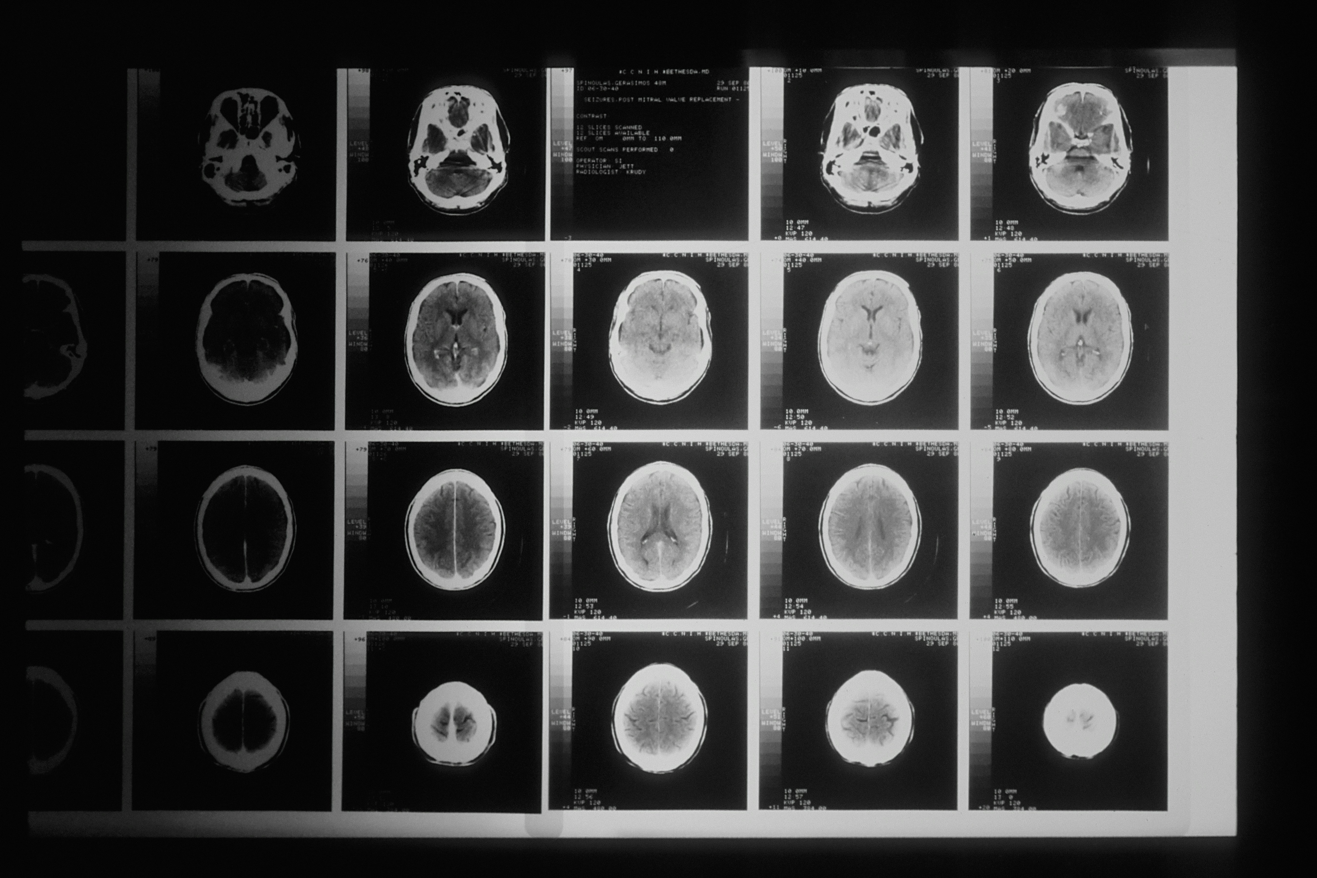 mri scan